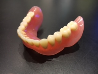 コンフォート義歯１